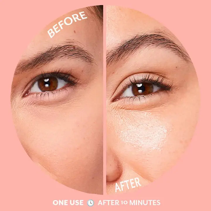 UNDER EYE Bubbly Eye Gels Patches with Niacinamide